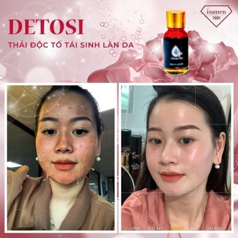 Thải độc tố da Isamen Detosi Plus Beauty Lotion